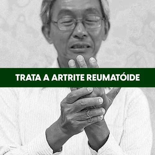 artrite